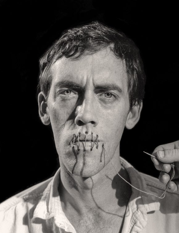 David Wojnarowicz with mouth swen up